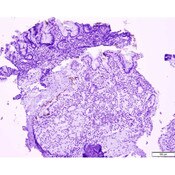 Control Slide, IHC, Helicobacter